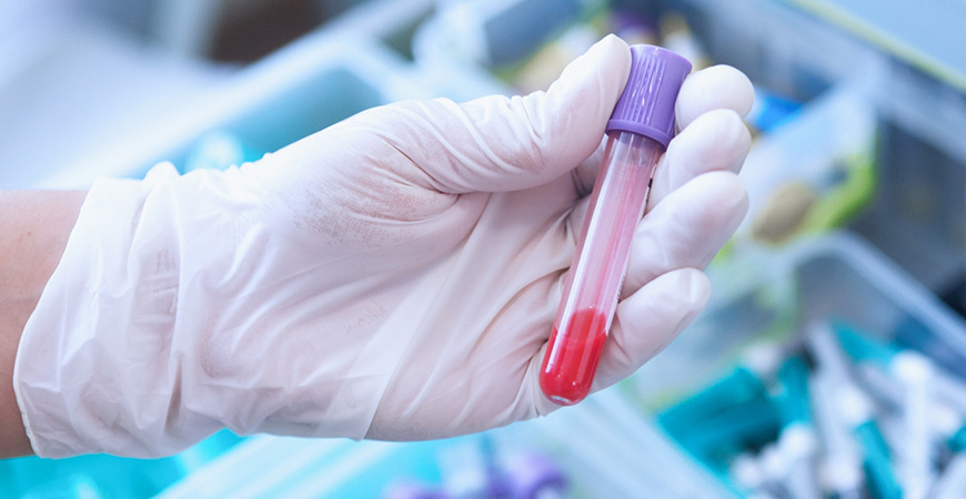 PRP(多血小板血漿)療法の実施